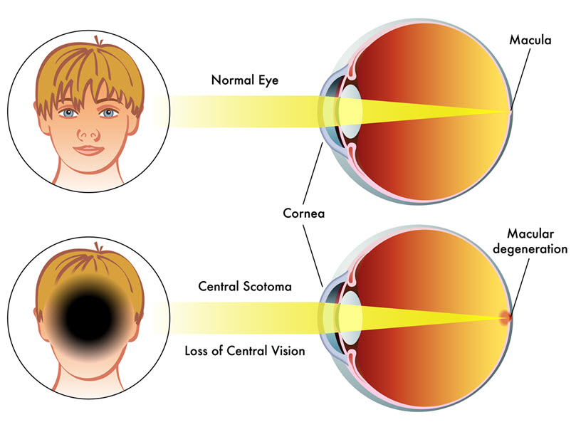 Macular Degeneration Eye Care Specialists of Michigan
